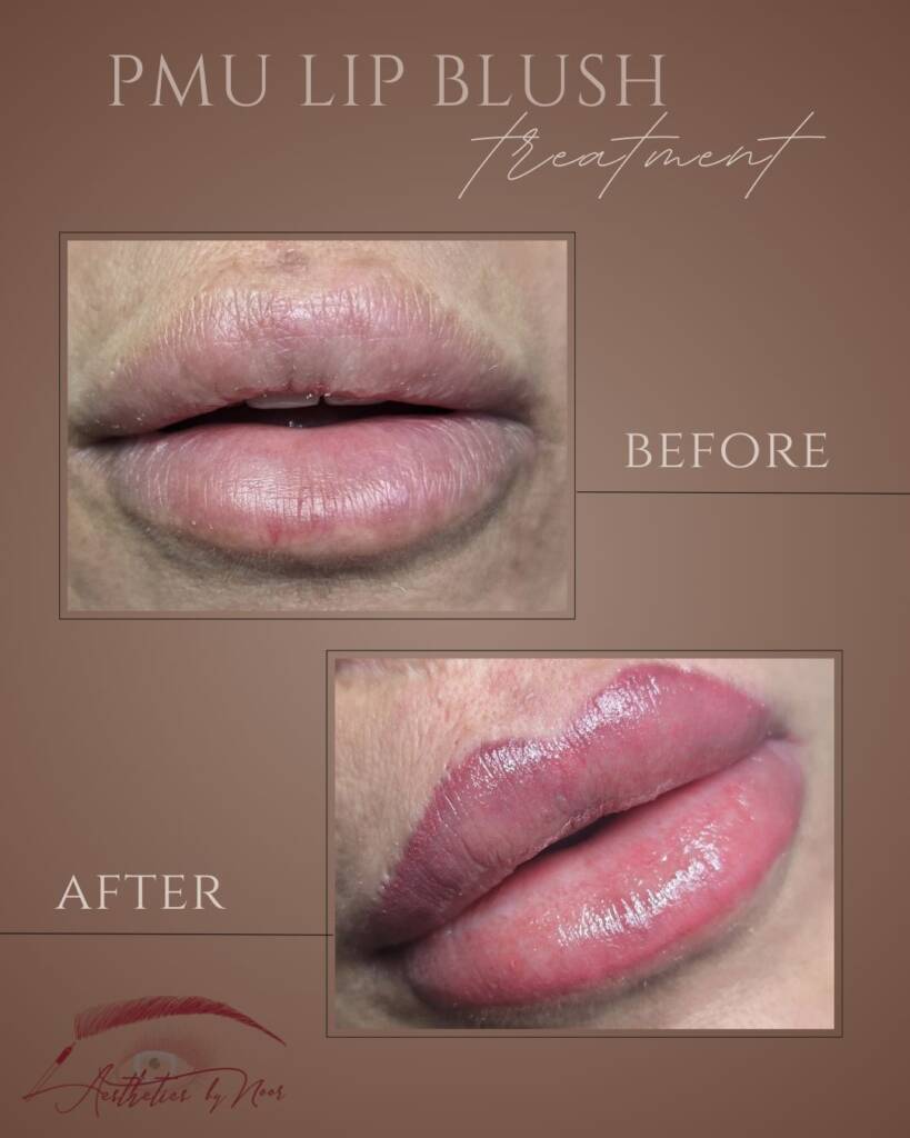 PMU Lip Blush treatment